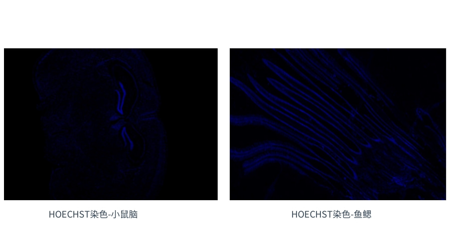 ZC-1164 HOECHST染色 (1).jpg